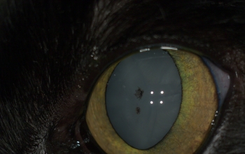 cataract en pigmentafzetting
