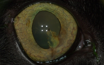 oogfotos_kat-vergroeiing-tussen-iris-en-voorste -lenskapsel